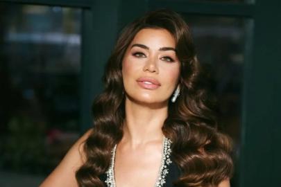 Ebru Şancı botoksu fazla kaçtı! Bir kaşı havada kaldı